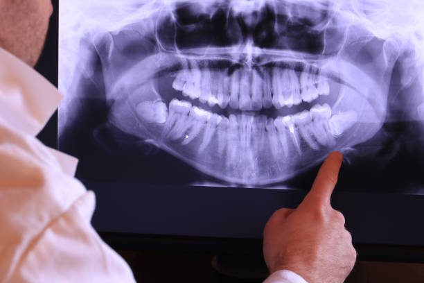 Best Holiday Emergency Dentist in Sharonville, OH